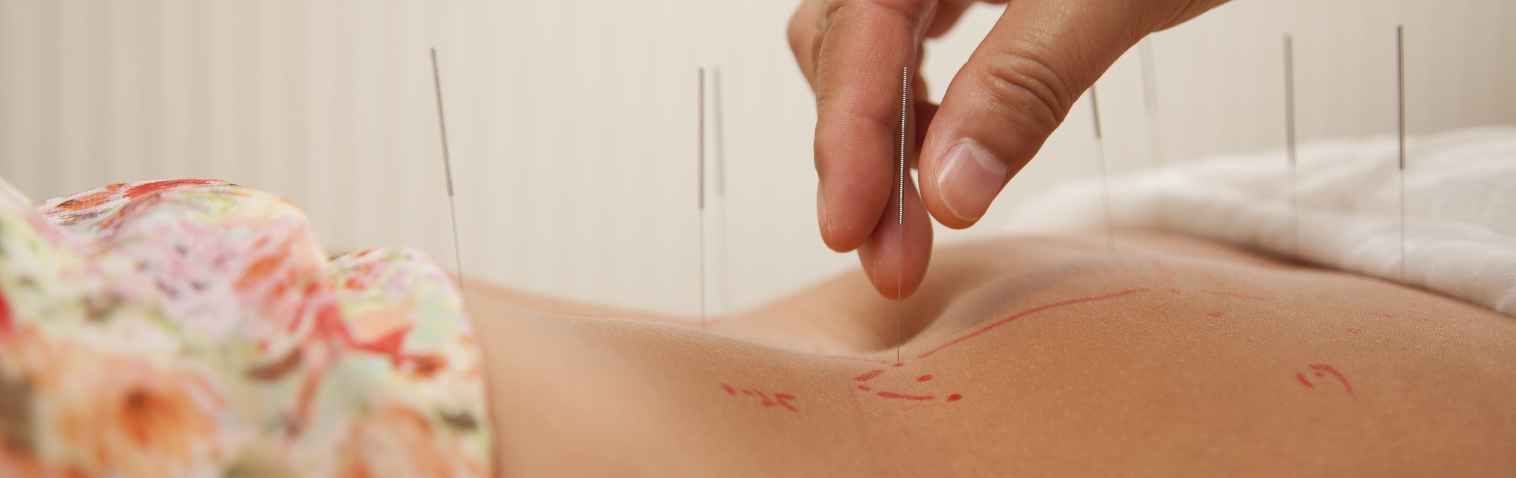 Acupressure treatment An Introduction to Acupressure Therapy